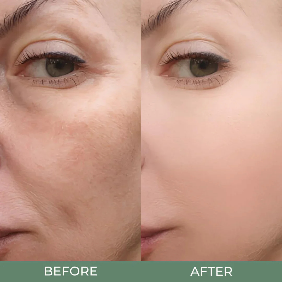 DrMelaxin Peel Shot Glow Rice Ampoule Duo
