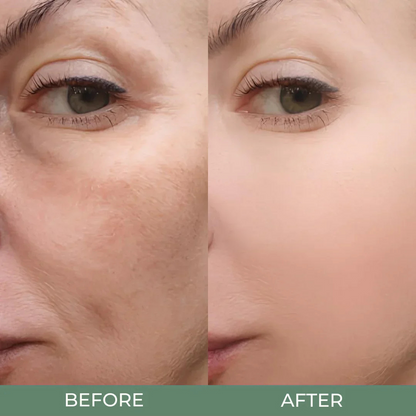 DrMelaxin Peel Shot Glow Rice Ampoule Duo